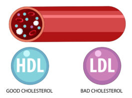 Magas lipoprotein(a)-szint - fontos tudni erről az örökletes lipidzavarról