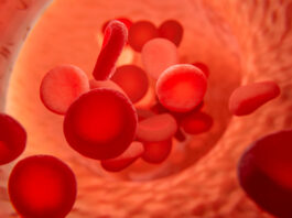 Mit szabad és mit nem, ha befejeződött a trombózis kezelése?