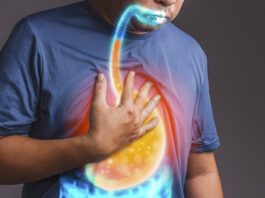 Mellkasi fájdalom, krákogás, fogromlás: furcsa tüneteket okozhat a reflux