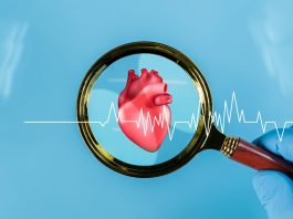 A szívinfarktus gyakori tünetei