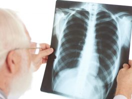 „Egy nap a tüdő egészségért”