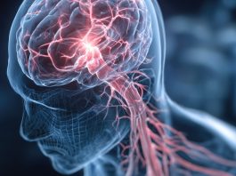 Homályos látás? Elnehezülő kar? – A stroke előjelei lehetnek Homályos látás? Elnehezülő kar? - A stroke előjelei lehetnek