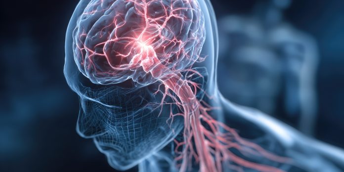 Homályos látás? Elnehezülő kar? - A stroke előjelei lehetnek