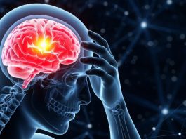 Megelőzhető-e a stroke? Megelőzhető-e a stroke?