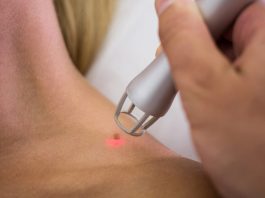 Hogyan szabadulhatunk meg a szemölcstől?