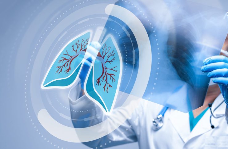 Komplex tüdőegészség-program