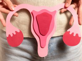 PCOS és mozgásszervi fájdalom – van köze egymáshoz?