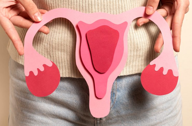 PCOS és mozgásszervi fájdalom – van köze egymáshoz?