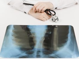 Ingyenes tüdőrákszűrés Ingyenes tüdőrákszűrés